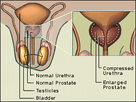 Prostate Diagram